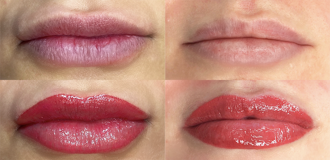 Transform Your Smile with Lip Blush and Lipstick Effect Tattooing in Ventura, California